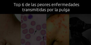 Top 6 de las peores enfermedades transmitidas por la pulga - Fumigación Universal, C.A top 6 de las peores enfermedades transmitidas por la pulga blog – fumigación universal - fumigación universal, c.a - page 16 top 6 de las peores enfermedades transmitidas por la pulga