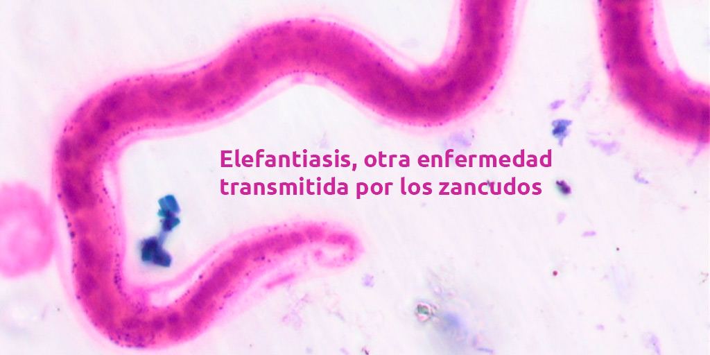 elefantiasis, otra enfermedad transmitida por los zancudos. elefantiasis, otra enfermedad transmitida por los zancudos. elefantiasis, otra enfermedad transmitida por los zancudos.