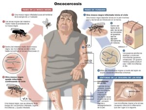 oncocercosis blog – fumigación universal - fumigación universal, c.a - page 13 oncocercosis