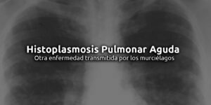 histoplasmosis pulmonar aguda blog – fumigación universal - fumigación universal, c.a - page 12 histoplasmosis pulmonar aguda